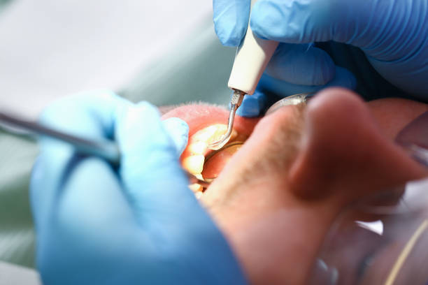 Best Chipped Tooth Repair Near Me  in Hicksville, NY